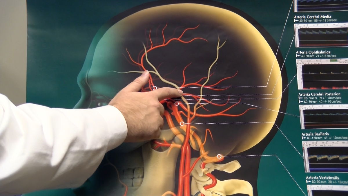 “Stroke Awareness Month” is a way to identify the signs and symptoms of a stroke.