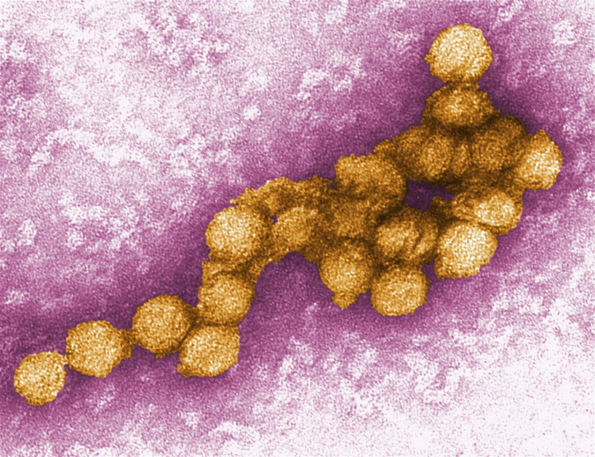 <i>Cynthia Goldsmith/CDC</i><br/>An electron micrograph shows the West Nile virus