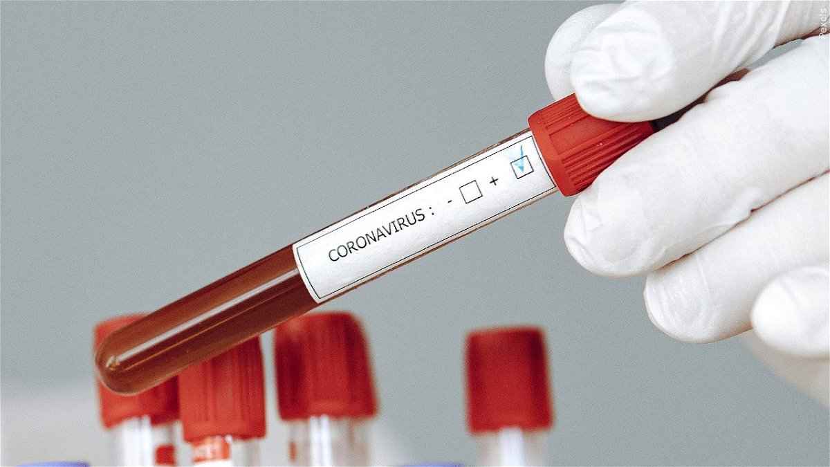 Test tube with positive coronavirus result