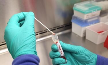 A swab that tested positive for the Monkeypox virus is seen at the UW Medicine Virology Laboratory on July 12 in Seattle