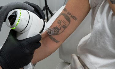 London-based tattoo removal studio NAAMA is offering free tattoo removal of Kanye West tattoos amid the musician's ongoing antisemitic comments.