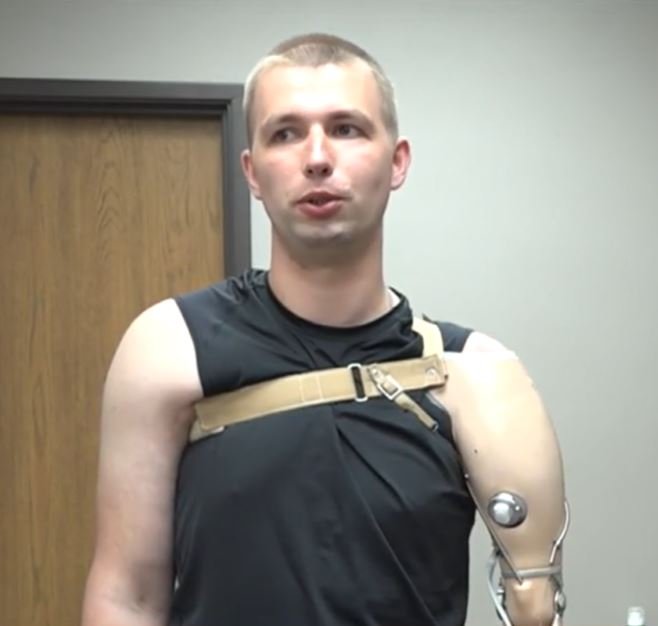 <i></i><br/>Andriy Mazuryk lost his left arm while trying to help his fellow soldiers on the battlefield. But nearly one year later Mazuryk received a prosthetic arm in Livonia