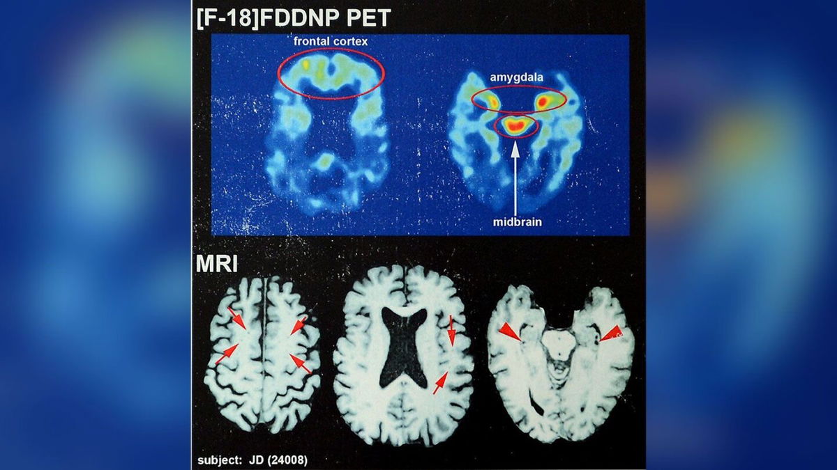 <i>Jeff Siner/Charlotte Observer/MCT/Getty Images</i><br/>The Concussion in Sport Group