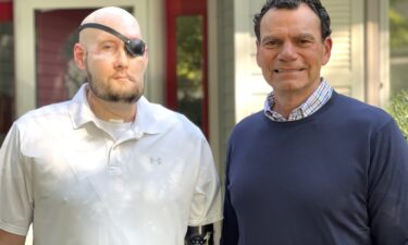 Aaron James and wife Meagan kiss for the first time after his whole-eye and partial face transplant surgery.