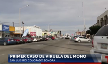 Reportan Primer Caso de Viruela Mono en San Luis