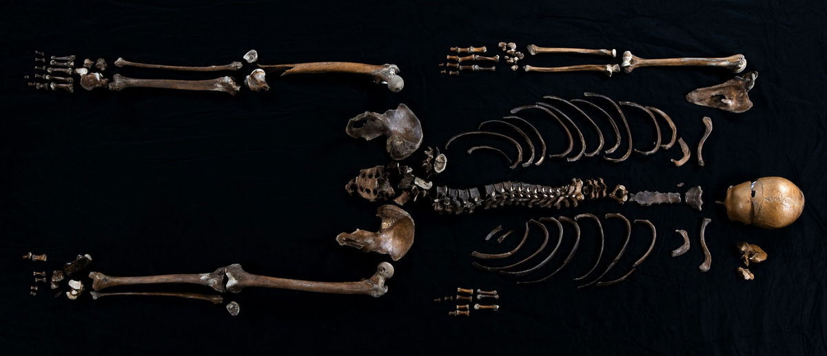 <i>Åge Hojem NTNU Vitenskapsmuseet via CNN Newsource</i><br/>Multiple excavations have helped researchers piece together Well-man's skeleton.