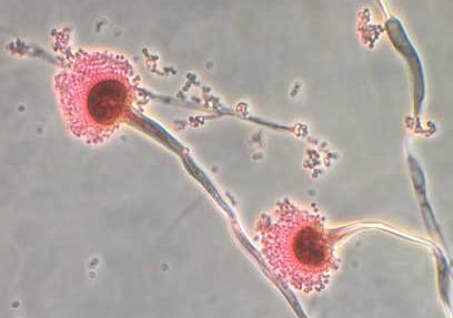 <i>Smith Collection/Gado/Archive Photos/Getty Images via CNN Newsource</i><br/>Aspergillus is a fungus that is very common in the environment