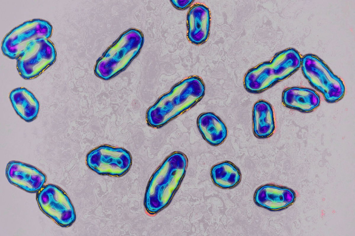 <i>BSIP/Universal Images Group/Getty Images via CNN Newsource</i><br/>Researchers have announced that they've discovered what allowed the bacterium Yersinia pestis