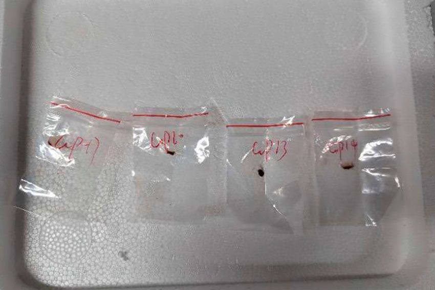 <i>United States District Court For The Eastern District Of Michigan/AP via CNN Newsource</i><br/>Authorities seized toxic plant pathogens that a Chinese scientist smuggled in his bag when he tried to enter the US last year.