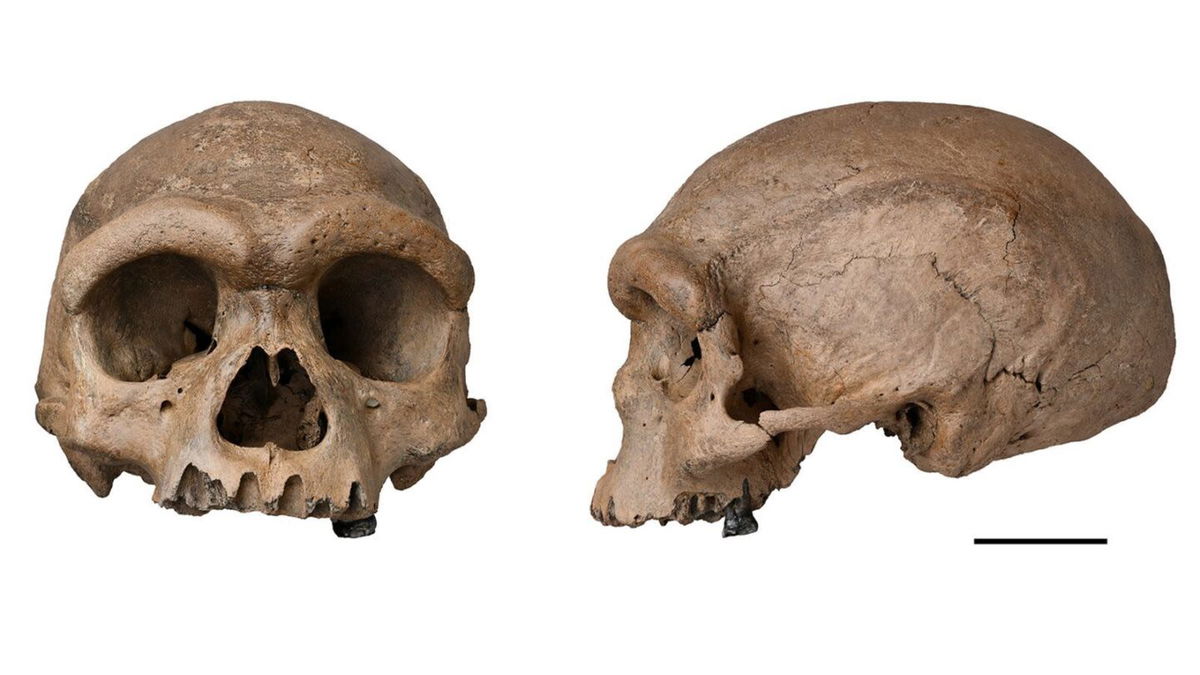 <i>Hebei GEO University via CNN Newsource</i><br/>The nearly complete cranium recovered from a well in Harbin