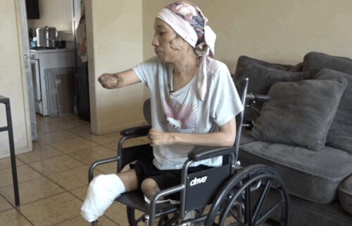 Arisbeth Munoz is now home after a harrowing battle with necrotizing fasciitis that led to multiple amputations.
