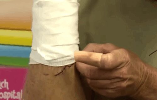 Saint Mary’s Medical Center in West Palm Beach hosts its first-ever shark bite survivor reunion