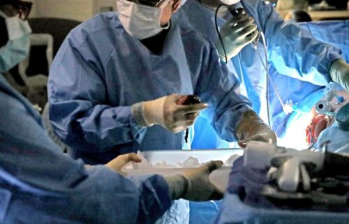 Health Resources and Services Administration Administrator Thomas Engels says the agency is undertaking a sweeping overhaul of the entity legally responsible for managing the organ waitlist and allocation nationwide.