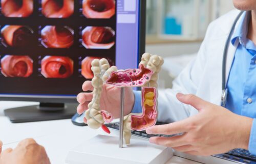 Whether someone is recommended for screening or not