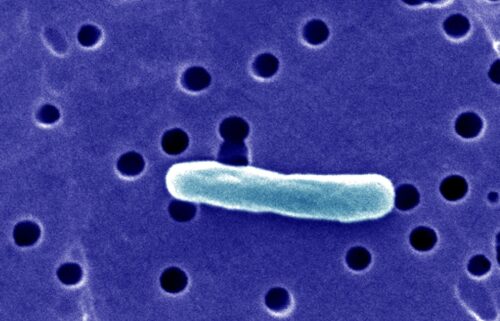 Twenty-one patients in Florida have become ill — some with E. coli — after consuming raw milk