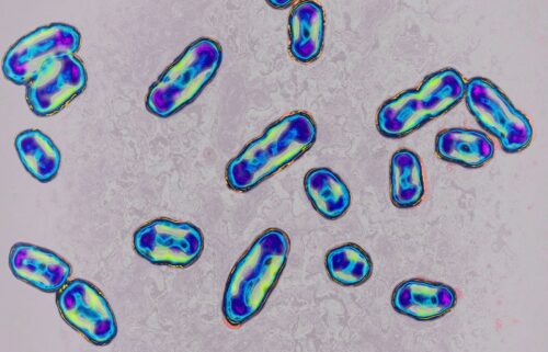 Plague is caused by the bacteria Yersinia pestis and is spread to humans through infected flea bites or contact with infected animals.
